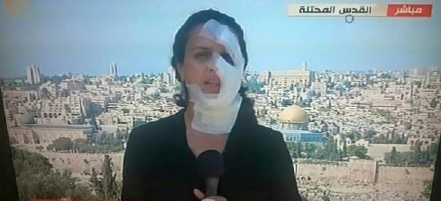 مراسلة الميادين، الصحافية هناء محاميد بعد اعتداء قوات الشرطة الإسرائيلية على الطواقم الصحفية في العيساوية